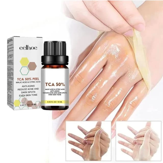 Suero exfoliante ácido, exfoliante químico para eliminar la cara, manchas de piel oscura, blanquea, aclara la solución exfoliante de melanina, exfoliación de la piel