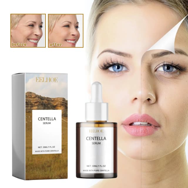 Centella Asiatica-suero Facial hidratante, mejora nutritiva, suaviza la piel seca, rejuvenecimiento, brillo, belleza y salud